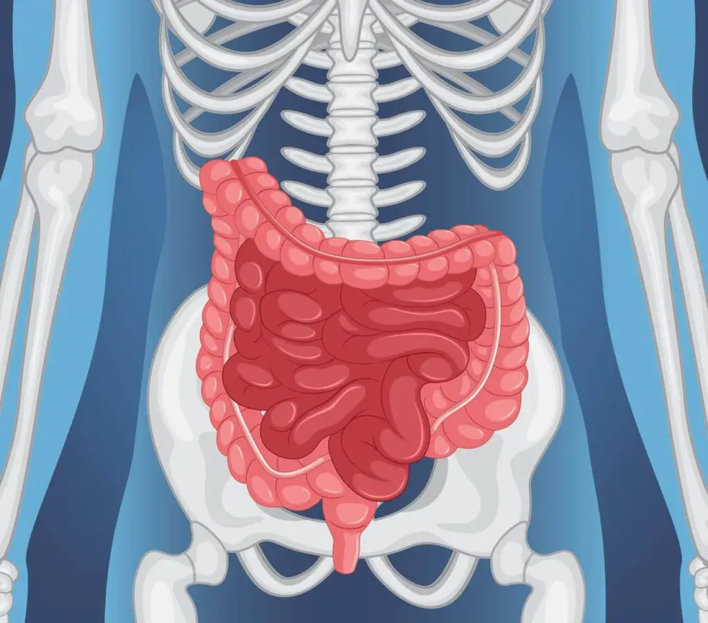 Cum se desfasoara operatia de ocluzie intestinala