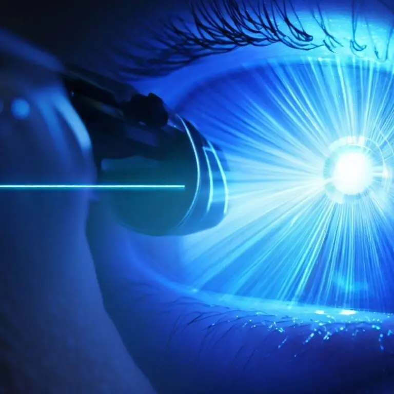 Operație cu Laser la Ochi: Cum funcționează și cine ar trebui să ia în considerare acest procedeu